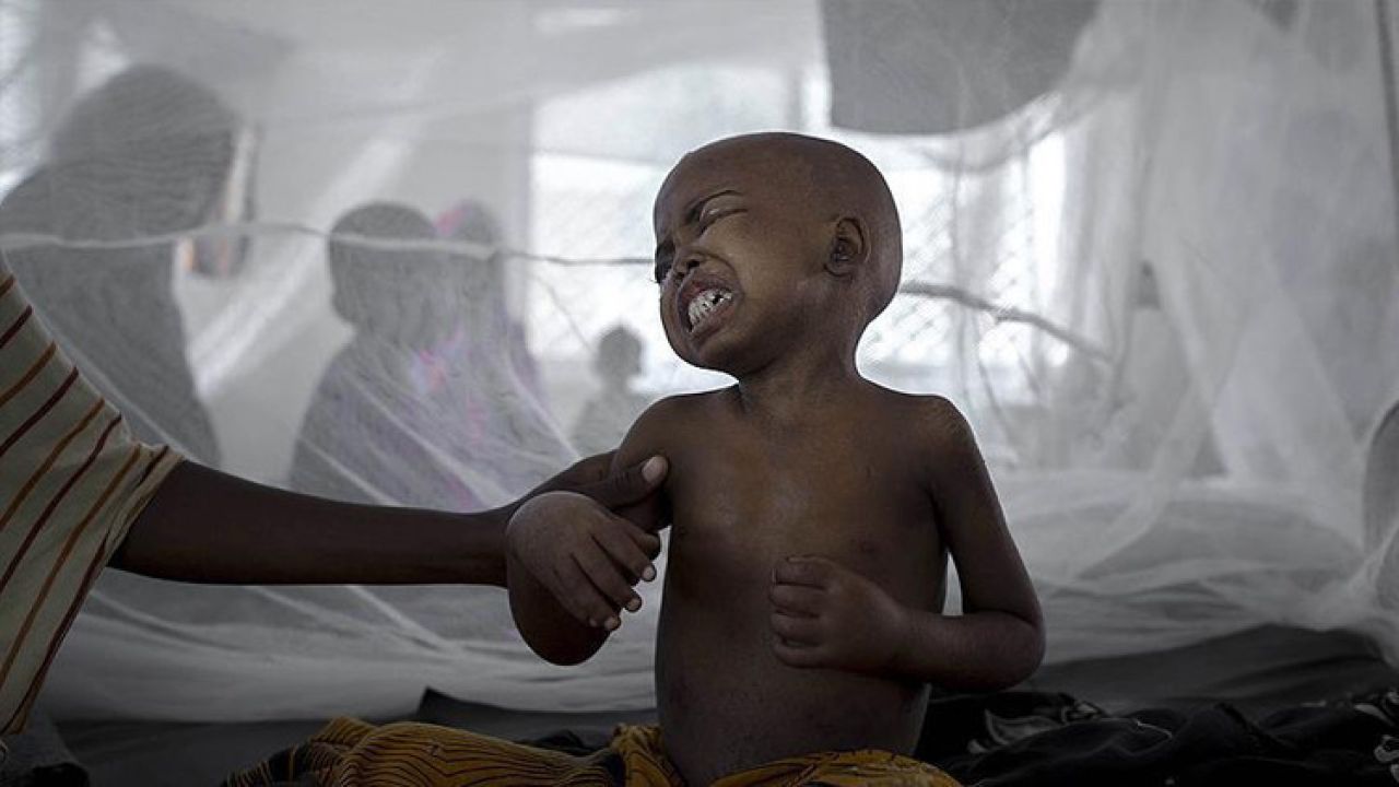 Afrika ülkesinde kolera alarmı: Acil tedbirler devreye alındı