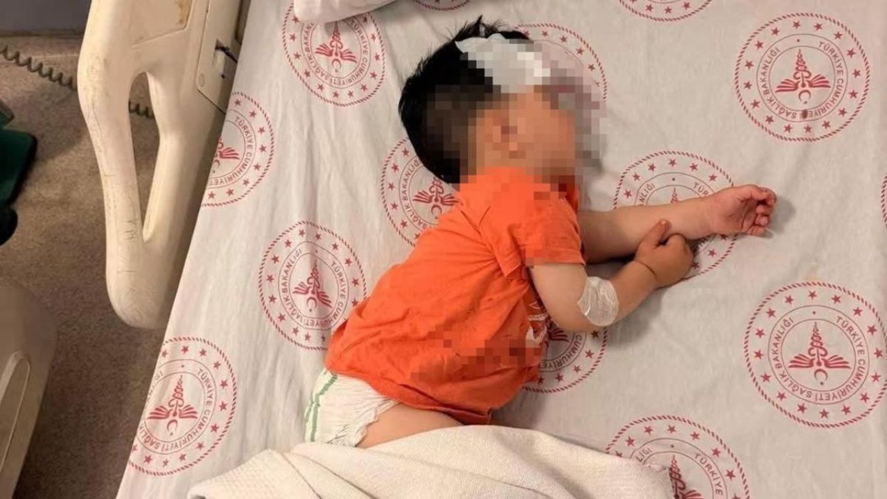 Sokak köpeklerinin saldırdığı 1 buçuk yaşındaki çocuk yaralandı
